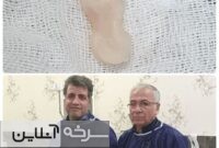 کله‌پاچه، لقمه‌ای خوش‌طعم اما پرخطر