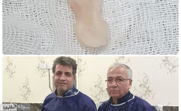 کله‌پاچه، لقمه‌ای خوش‌طعم اما پرخطر